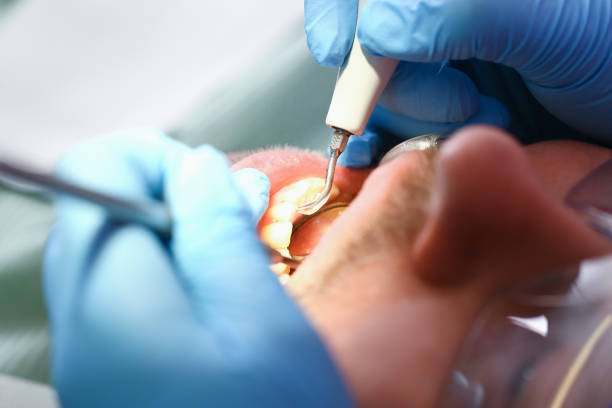 Best Cracked Tooth Emergency Dentist  in Kamas, UT